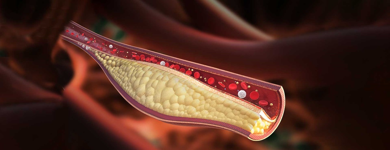 The Most Effective Cholesterol Supplements In 2023 – A Buyer’s Guide